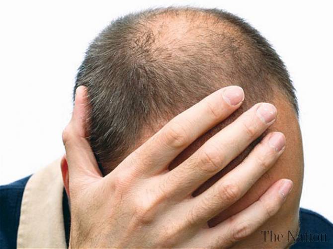 Foligain против косопад е хранителна добавка, която укрепва косъма, богата на витамини и минерали.